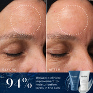A before-and-after comparison of a woman's forehead shows improved moisturisation levels in the skin. Below the images, text states 94% of particpants agreed.