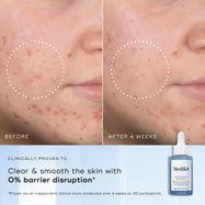 Before and after comparison of skin with a skincare product from Medik8.