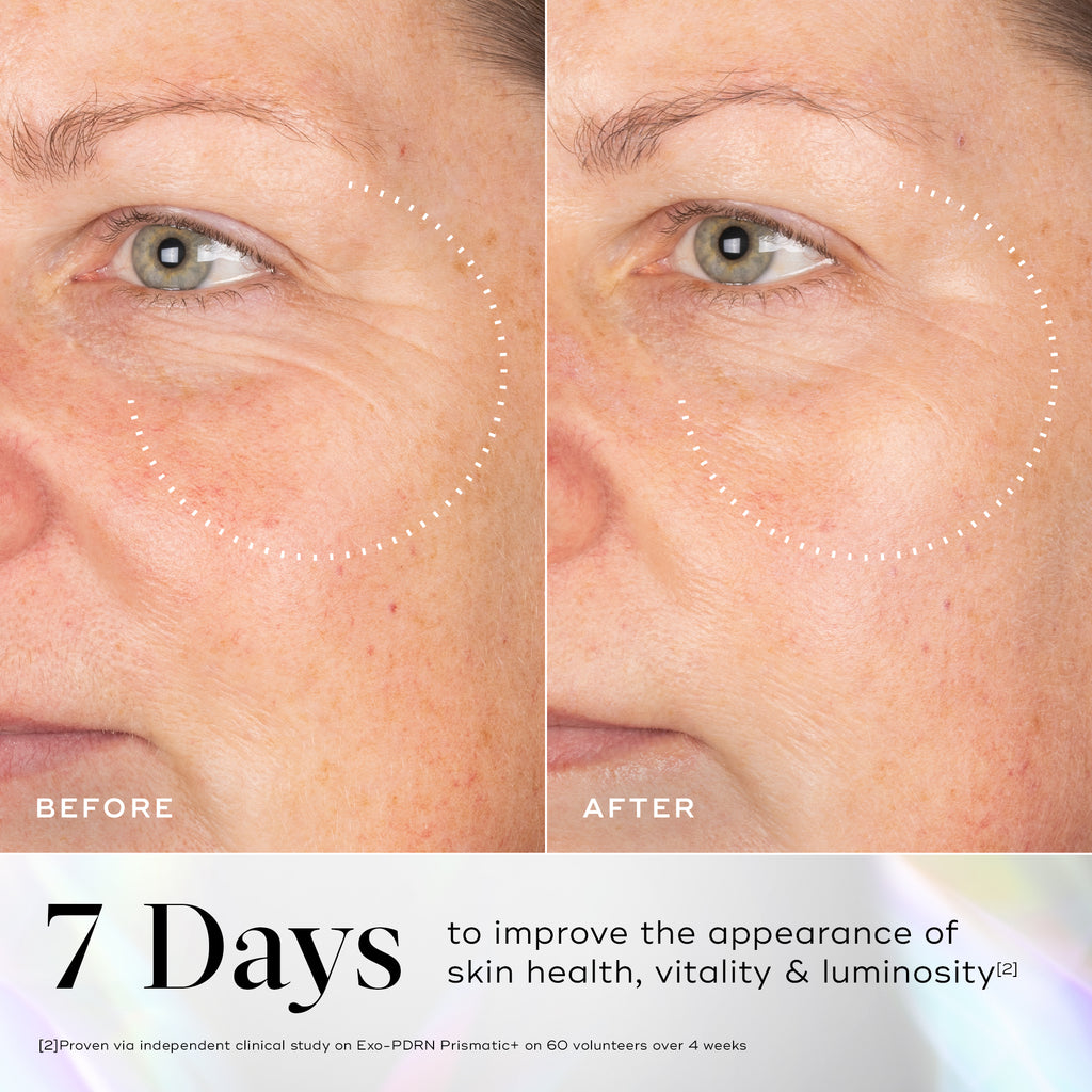 Before-and-after images of skin showing visible wrinkles around the eye area with improvement highlighted after using Medik8 Exo-PDRN Prismatic+ serum.