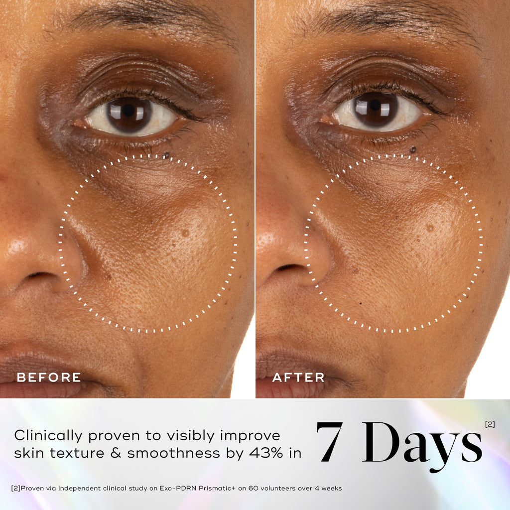 Before-and-after images of skin around the eyes showing improved skin vitality and luminosity after 7 days of using Medik8 Exo-PDRN Prismatic+.