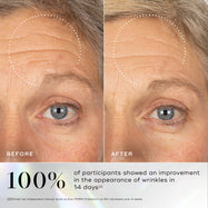 Before-and-after comparison showing visible improvement in skin texture and smoothness after continued use of Medik8 Exo-PDRN Prismatic+.
