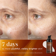Before and after comparison of a participant’s skin over 7 days, showing visibly brighter skin with improved radiance and even tone.