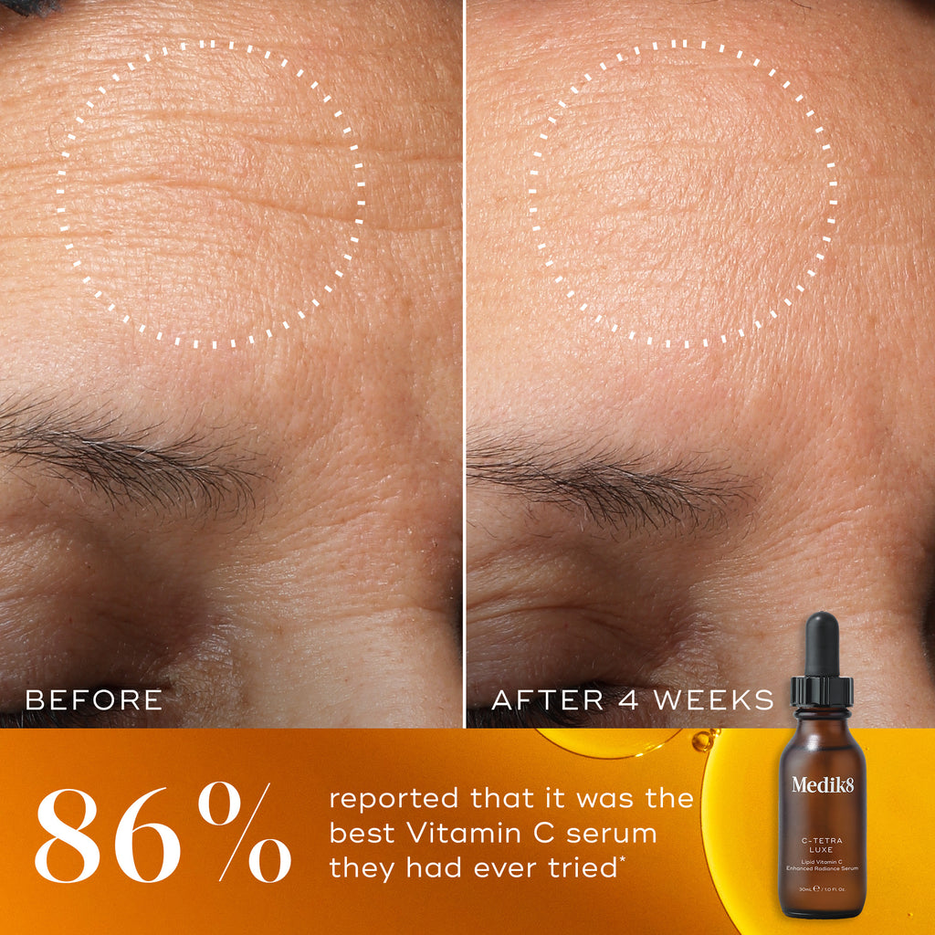 Before and after comparison of skin texture with a bottle of Medik8 serum.